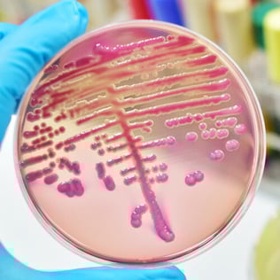Mycoplasma Contamination