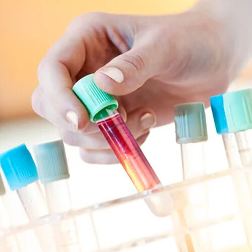 Cell Culture Reagents Cell Culture Reagents